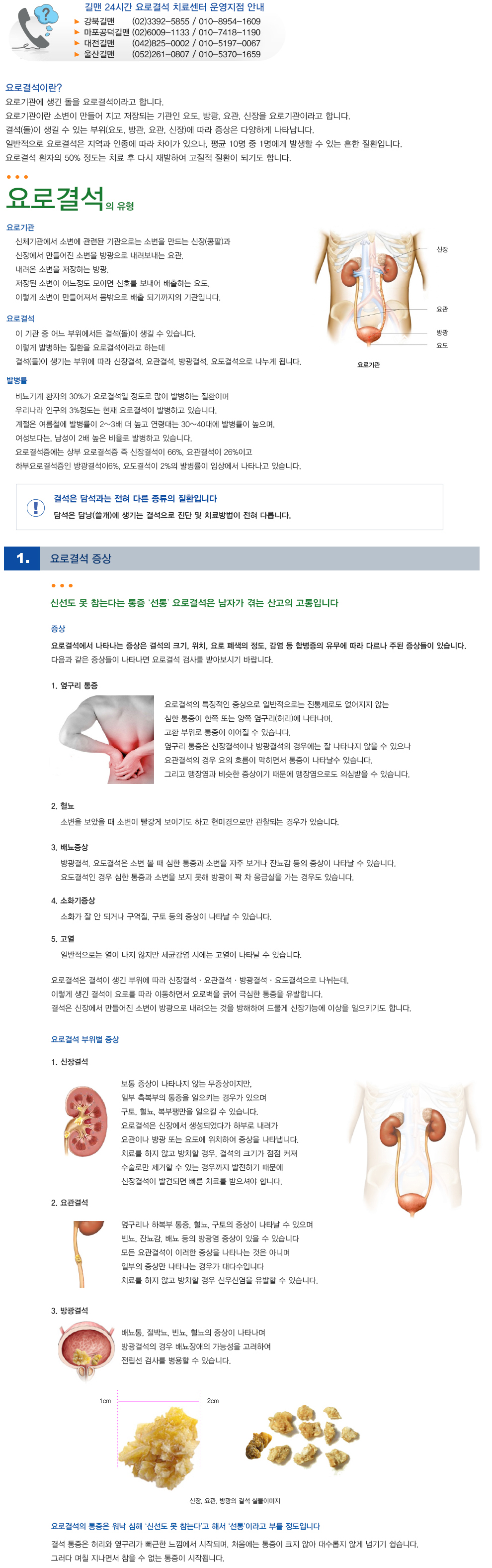 요로결석